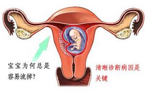 宫外孕有什么前期表现可以看出来?